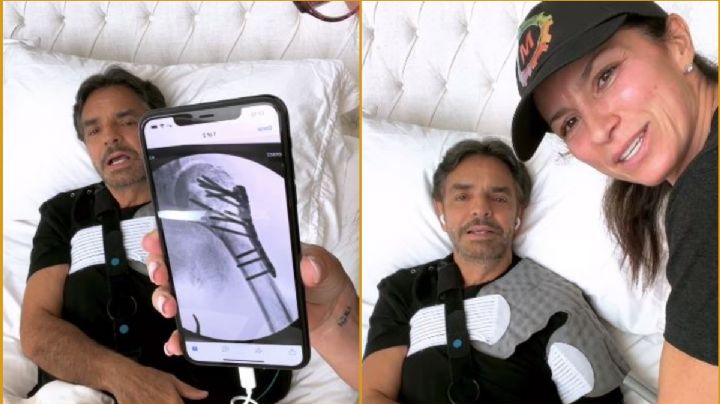 Eugenio Derbez relata que “se le salió el hombro” en doloroso accidente por jugar VR | VIDEO