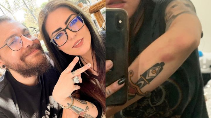 Eva de Metal acusa a su esposo Jano de maltrato y muestra evidencia en redes sociales | FOTOS