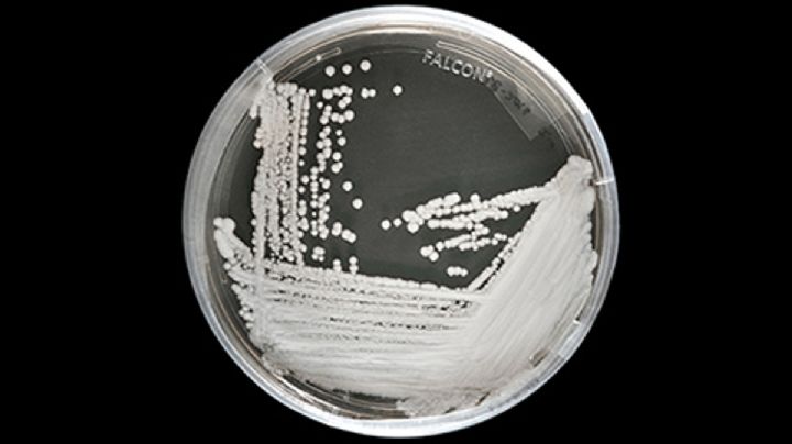 Candida Auris: Alerta mundial por aumento de casos de hongo mortal; ¿cuáles son los síntomas?