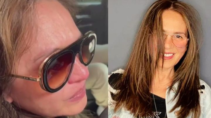 Yolanda Andrade: ¿Qué es un aneurisma cerebral, qué lo provoca y qué tan grave es?