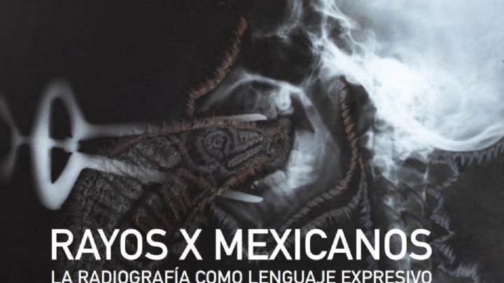 Radiografías artísticas serán premiadas hasta con 30 mil pesos en OAXACA; ¿Cómo participar y hasta cuándo cierra la convocatoria?