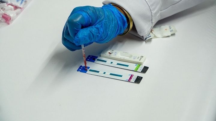 Reportan 419 casos nuevos de VIH en Oaxaca durante primeros seis meses de 2025